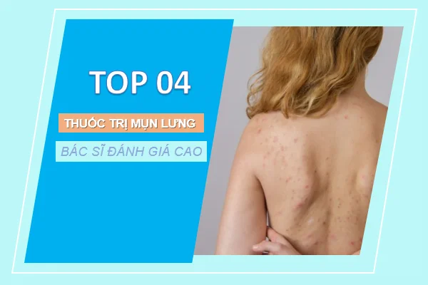 Top 04 thuốc trị mụn lưng được bác sĩ đánh giá cao Top 04 thuốc trị mụn lưng được bác sĩ đánh giá cao